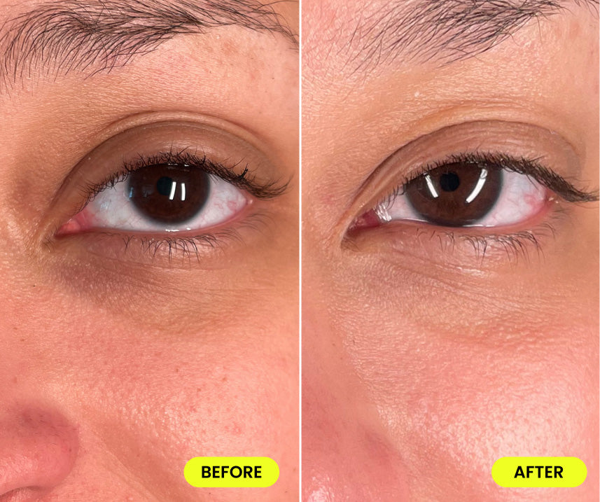 before and after image