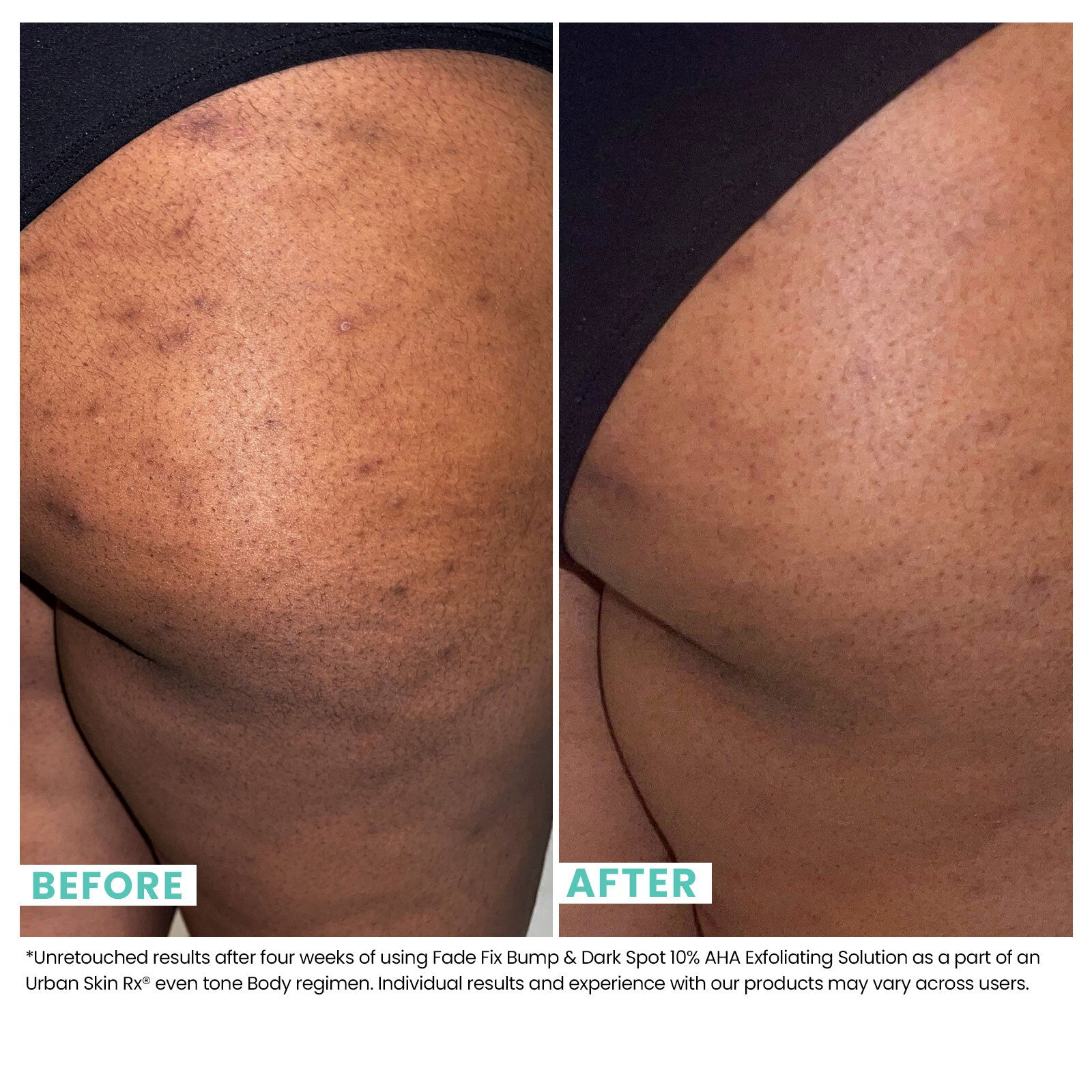 Fade Fix Bump & Dark Spot 10% AHA Exfoliating Solution