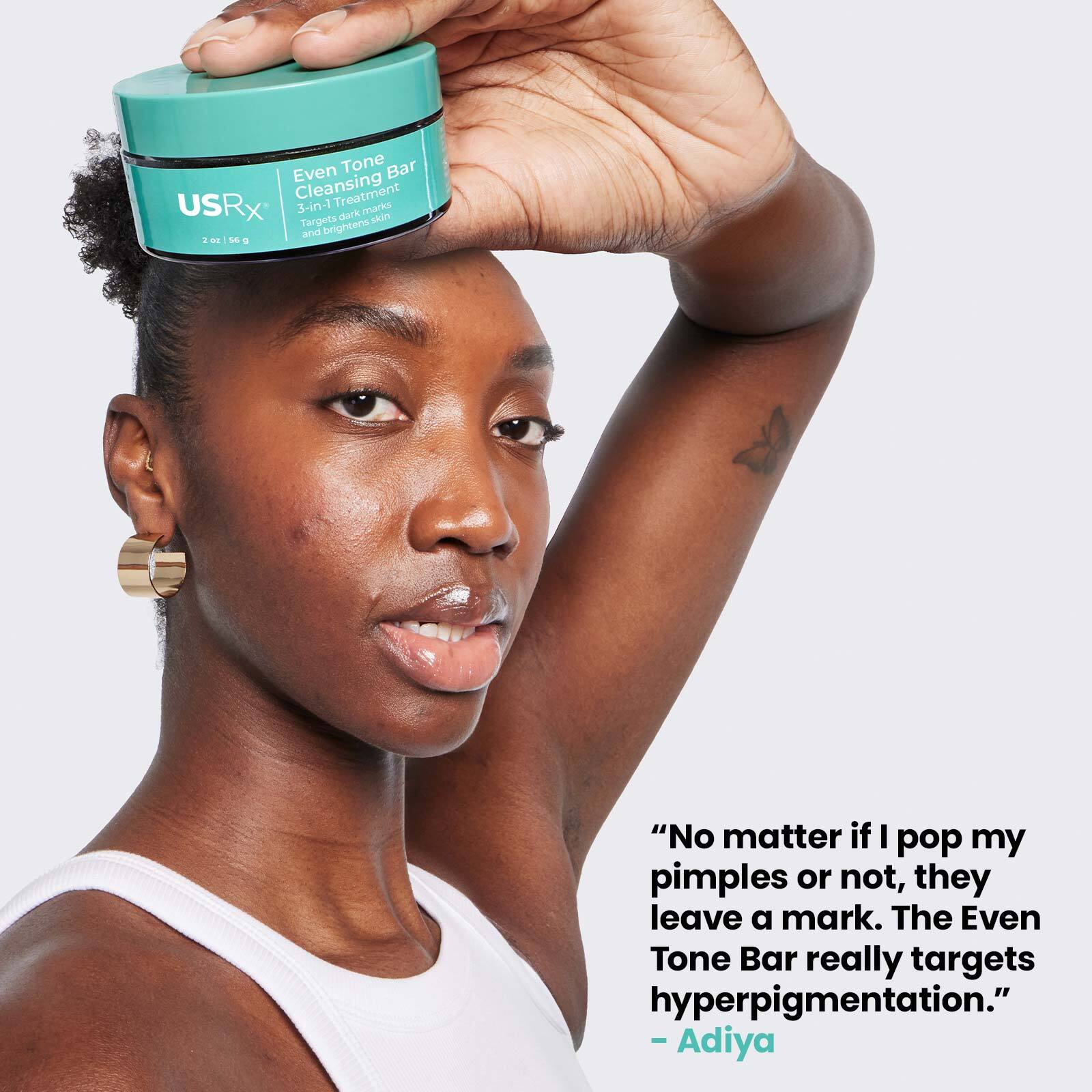 No matter if I pop my pimples or not they leave a mark. The even tone bar really targets hyperpigmentation. Adiya.