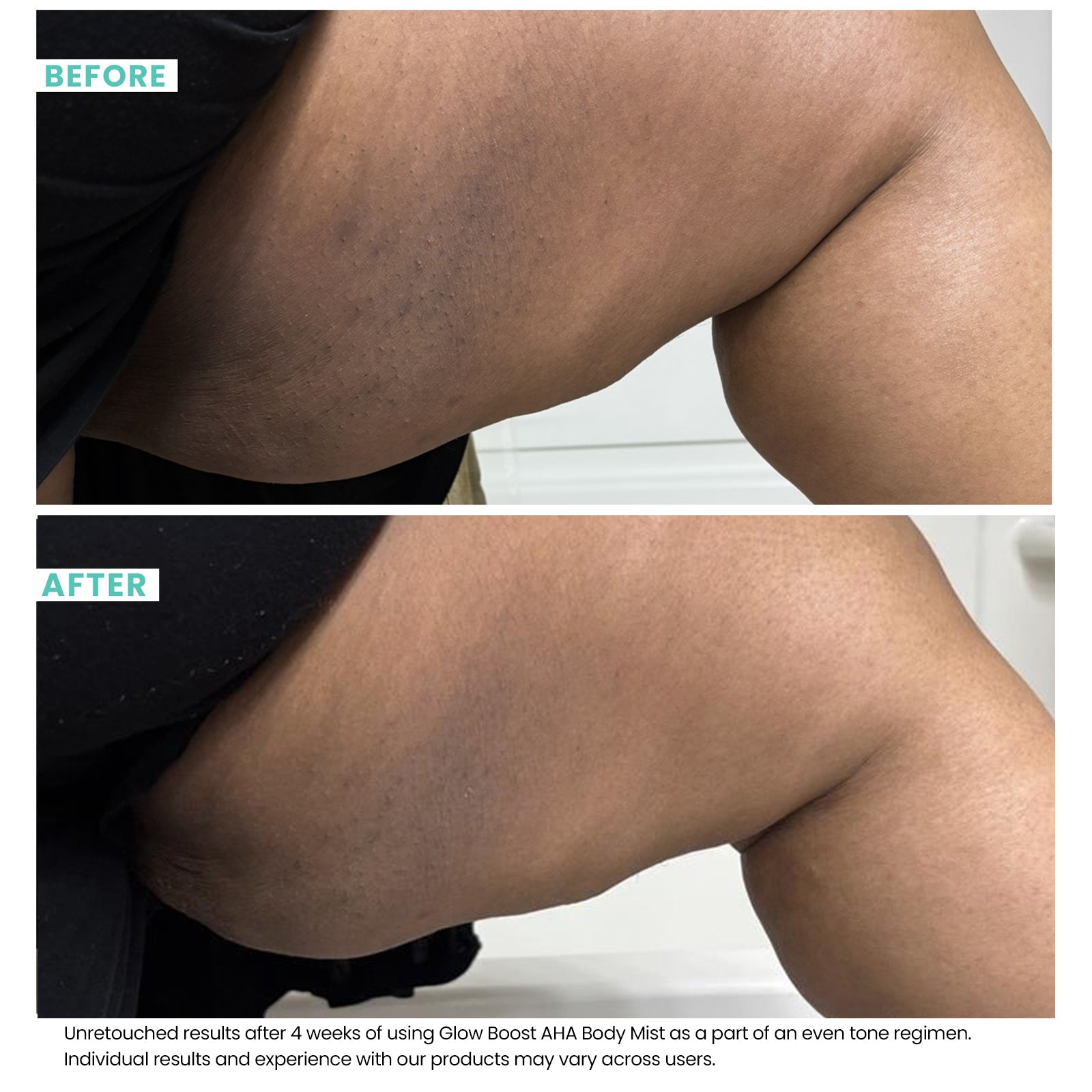Woman's skin before and after using USRx Glow Boost AHA Body Mist with visibly improved skin