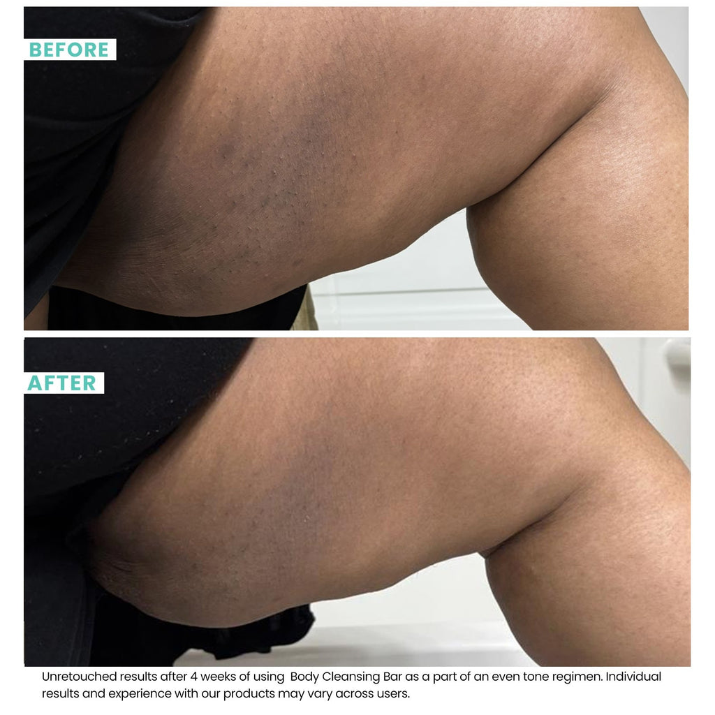 Woman's skin before and after using USRx even tone regimen