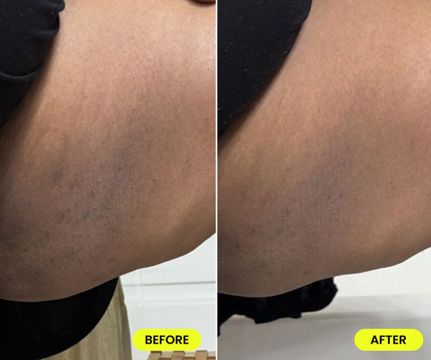 before and after image