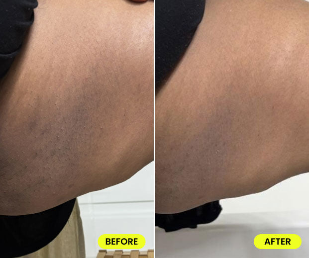 before and after image