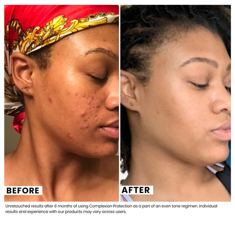 Complexion Protection Moisturizer SPF 30