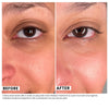 Woman's skin before and after using USRx VitalEyez Treatment