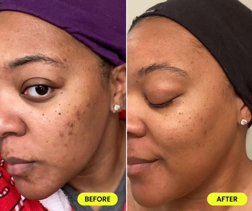 before and after image