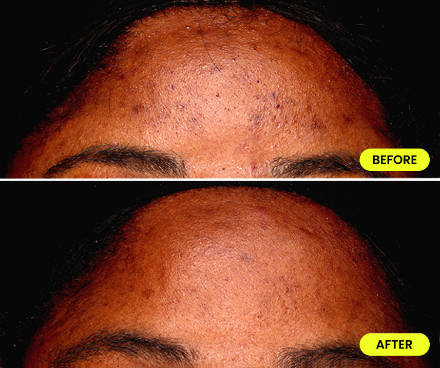 before and after image