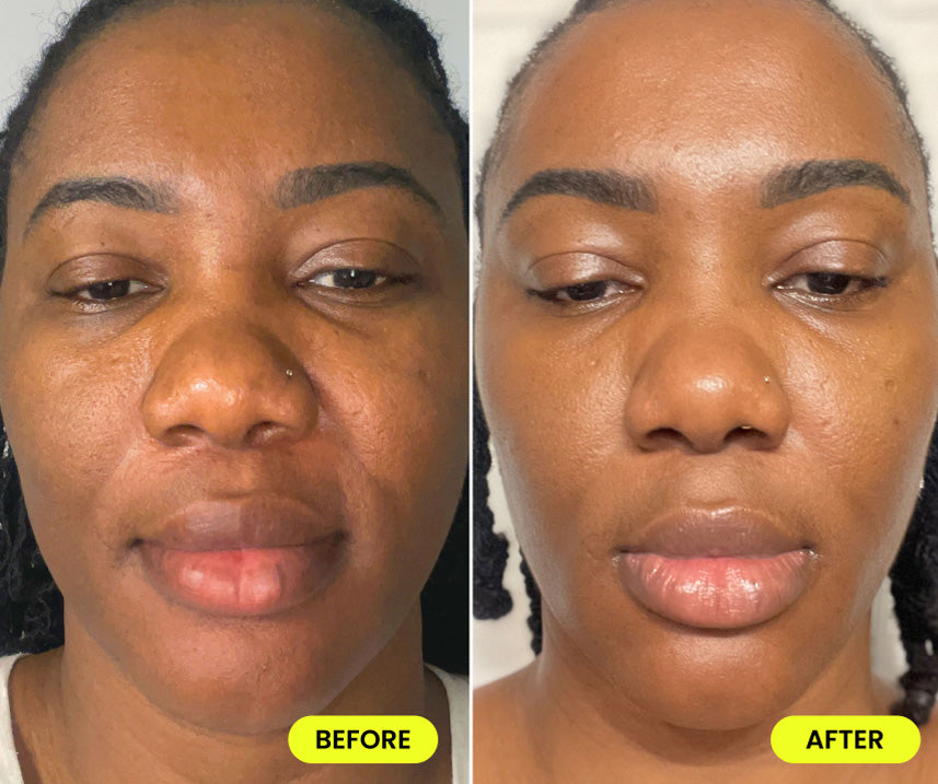 before and after image