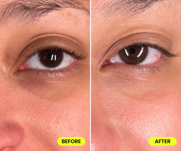 before and after image