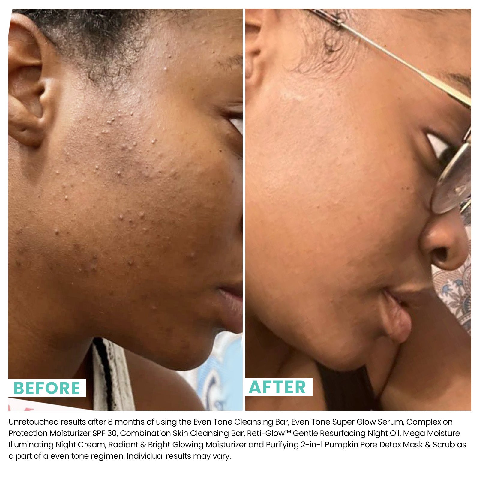 Brighter Days Dark Spot AHA Polish