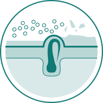 Hair Bump Relief Step 2 image