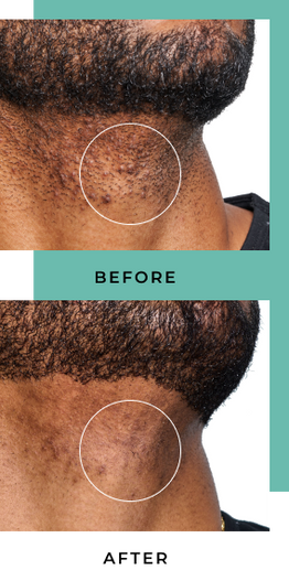 Before and After image