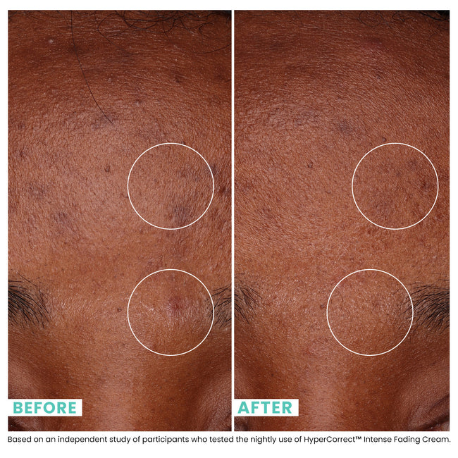 before and after image